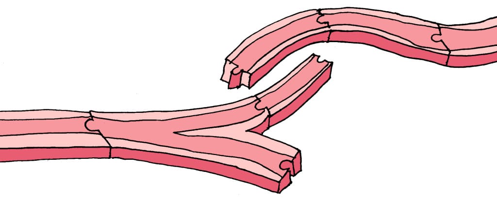  Signal paths in the brain can be compared with railways. In a psychosis is changing track "locked up" in the wrong position, so that the impulses in the brain are going in the wrong lanes.